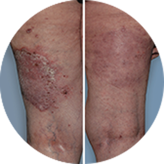 Knees