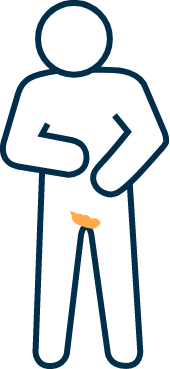 Human icon with plaque psoriasis in sensitive areas